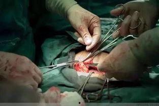 成人切我缝针图片视频